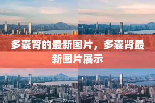 多囊肾的最新图片,多囊肾最新图片展示中山市多米克自动化设备有限公司